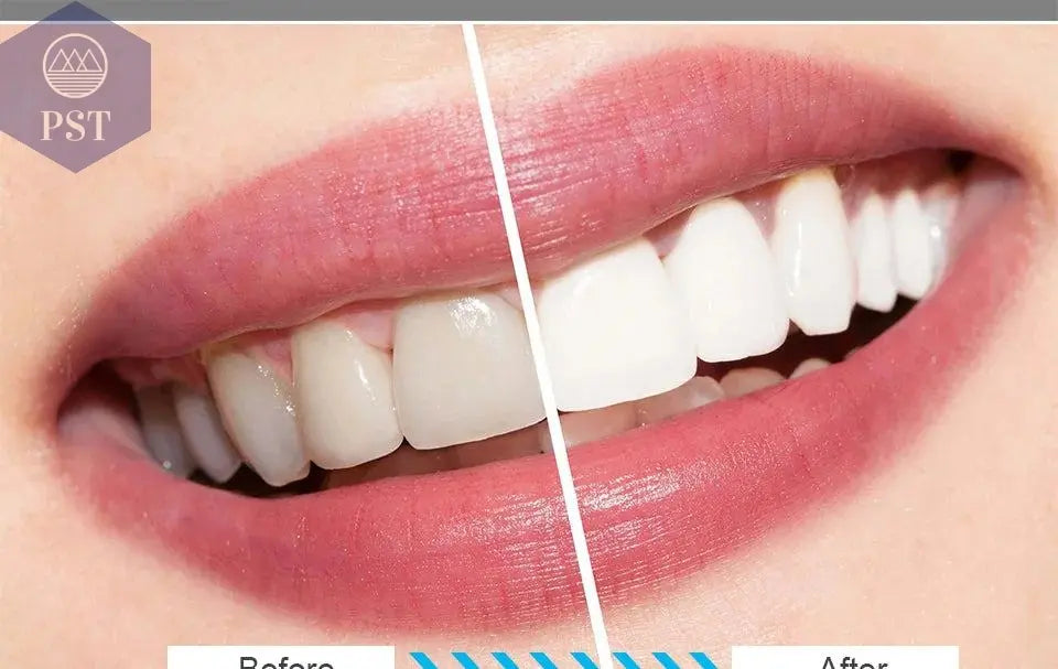 Electric Toothbrush Sonic Rechargeable Top Quality Smart Chip Toothbrush Head Replaceable Whitening Healthy Best Gift ! - PST PS Tradings